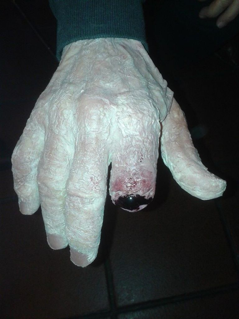 Mano zombie con dito mozzato