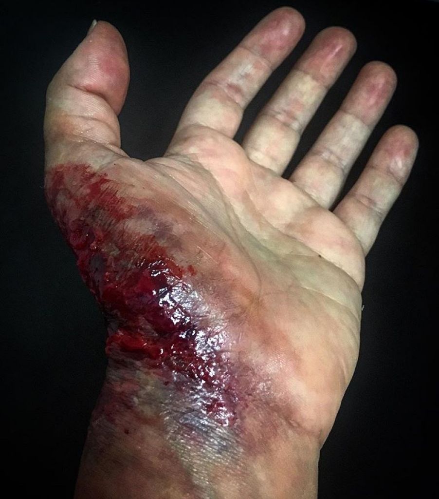 Destroyed Hand