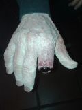 Mano zombie con dito mozzato